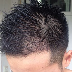 发际线分享社区