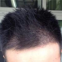 發(fā)際線用戶圖片