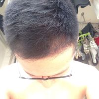 發(fā)際線用戶圖片