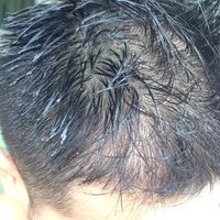 發(fā)際線用戶圖片