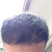 發(fā)際線用戶圖片