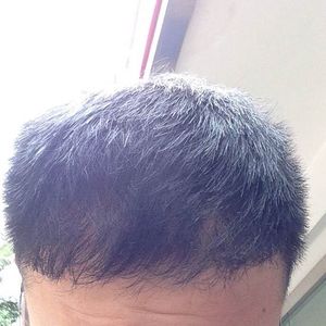 发际线分享社区