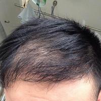 發(fā)際線用戶圖片
