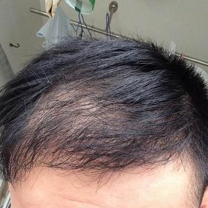 发际线分享社区