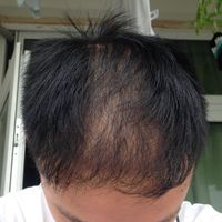 發(fā)際線用戶圖片