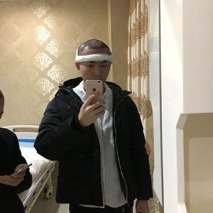 发际线分享社区