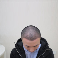 發(fā)際線用戶圖片