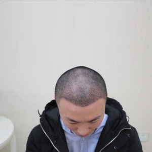 发际线分享社区