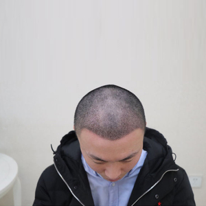 发际线分享社区