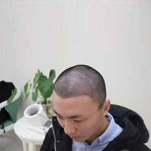 发际线分享社区