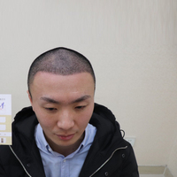 發(fā)際線用戶圖片
