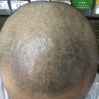 發(fā)際線用戶圖片
