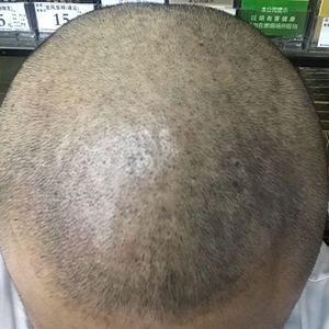 发际线分享社区