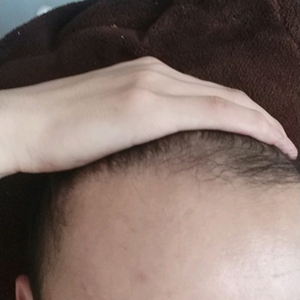 发际线分享社区