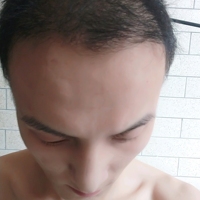 發(fā)際線用戶圖片