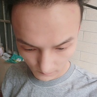發(fā)際線用戶圖片