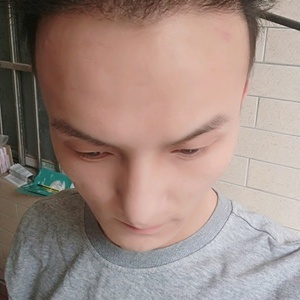 发际线分享社区