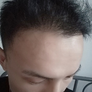 发际线分享社区