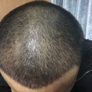发际线分享社区