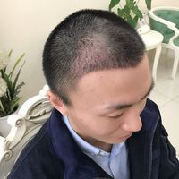 發(fā)際線用戶圖片