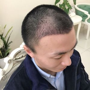 发际线分享社区
