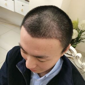 发际线分享社区