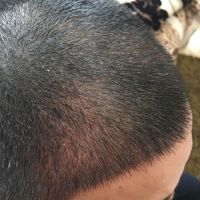 發(fā)際線用戶圖片