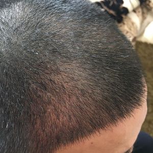 发际线分享社区