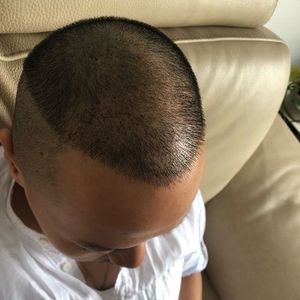 发际线分享社区