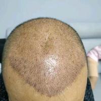 發(fā)際線用戶圖片