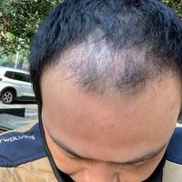 發(fā)際線用戶圖片