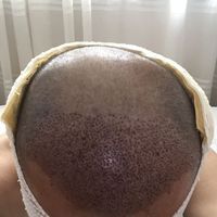 發(fā)際線用戶圖片