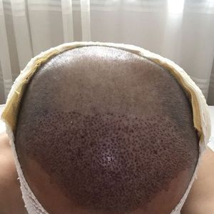 发际线分享社区