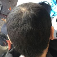 發(fā)際線用戶圖片