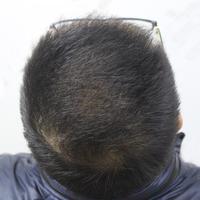 禿頂用戶圖片