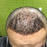發(fā)際線用戶圖片