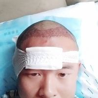 發(fā)際線用戶圖片