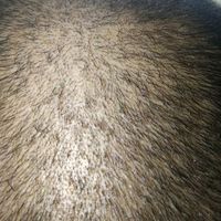 禿頂用戶圖片