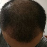 禿頂用戶圖片