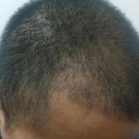 發(fā)際線用戶圖片