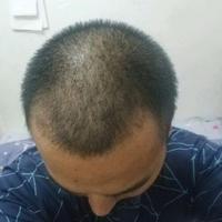 發(fā)際線用戶圖片