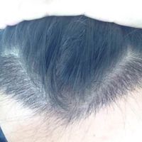 發(fā)際線用戶圖片
