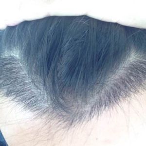 发际线分享社区