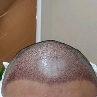 發(fā)際線用戶圖片