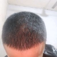 發(fā)際線用戶圖片