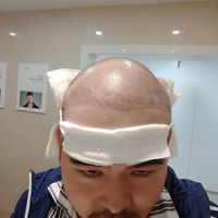 發(fā)際線用戶圖片