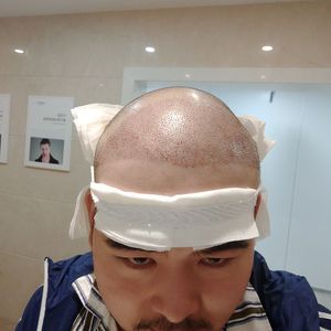 发际线分享社区