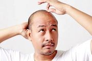 前额脱发严重怎么办？四种治疗方法
