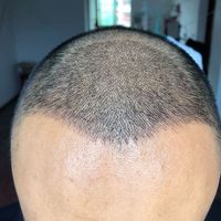 發(fā)際線用戶圖片