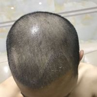 發(fā)際線用戶圖片